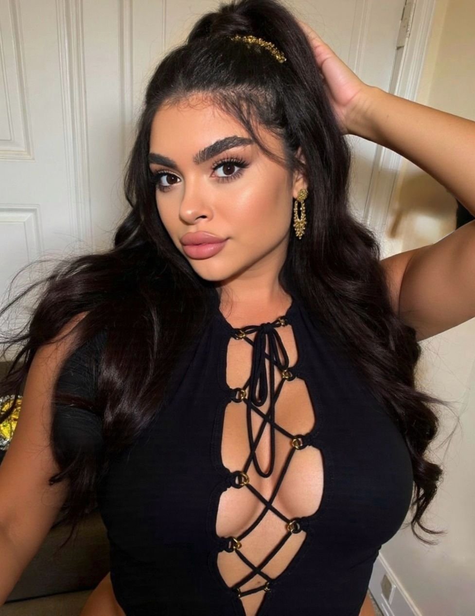 Esmi